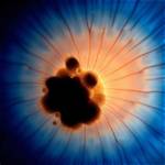 Which Tissue Found in Iris?