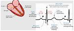 Which Waveform Represents Atrioventricular Conduction?