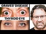 Which Way Do Graves Face?