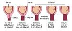 Which Week Do You Start Dilating?