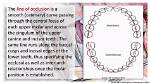 Who Develop Normal Occlusion Theory?