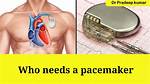 Who Needs a Pacemaker?