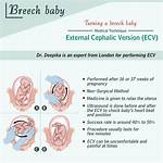 Who Performs an Ecv?