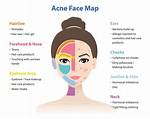 Why Acnes on Face?
