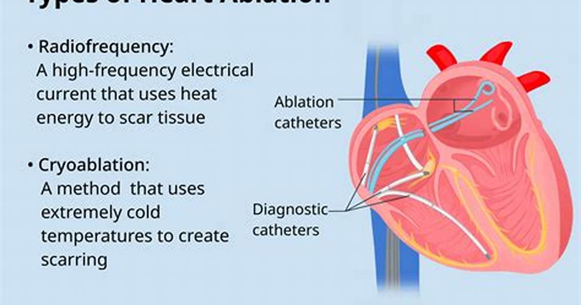 Why Are Ablations Done?