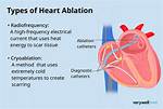 Why Are Ablations Done?