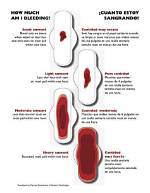 Why Bleeding After Sweep?