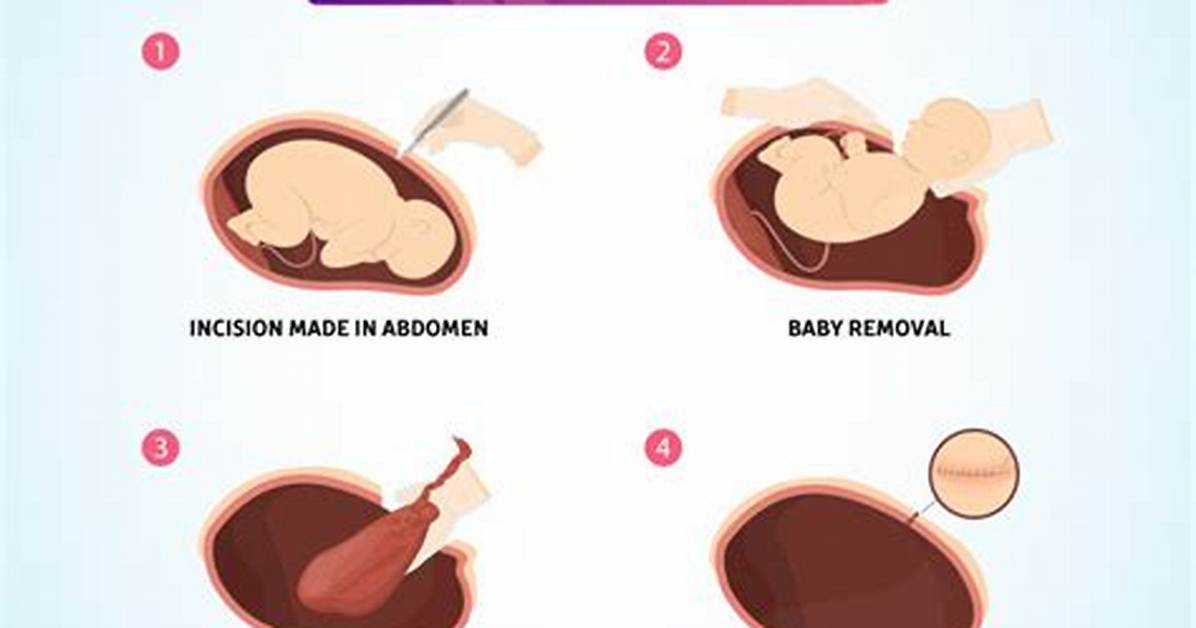 Why C Section Shelf?