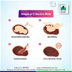 Why C Section Shelf?