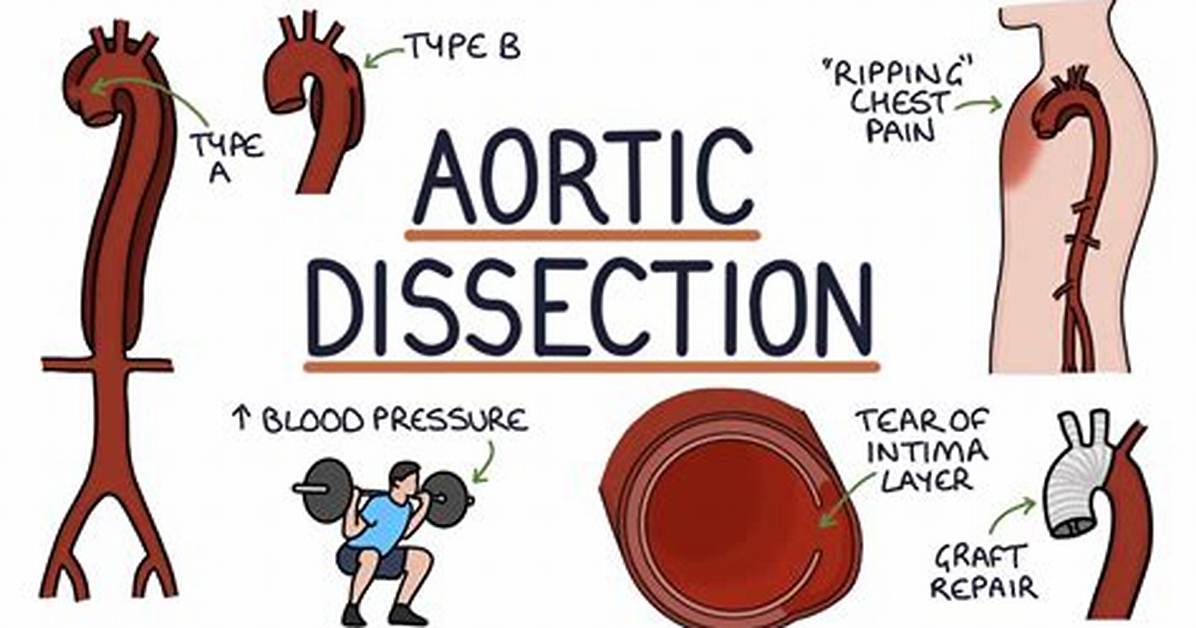 Why Dissection Is Wrong?