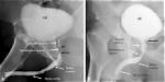 Why Do a Urethrogram?