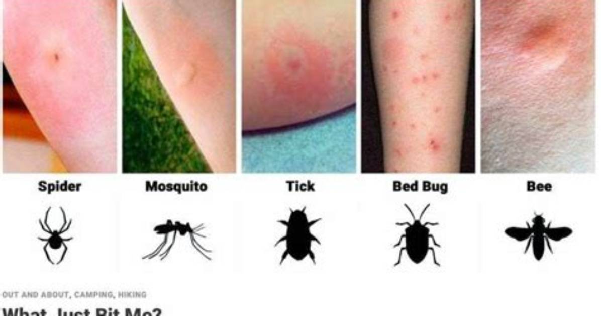 Why Do Bugs Always Bite Me?