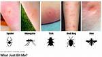 Why Do Bugs Always Bite Me?