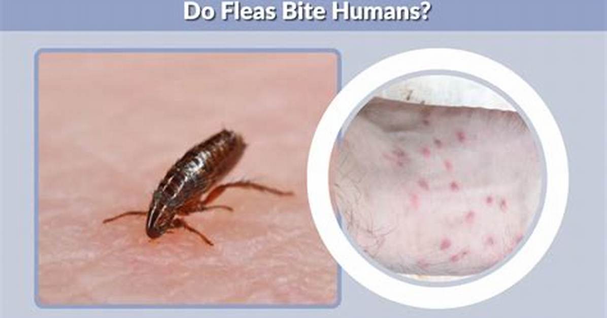 Why Do Fleas Bite Me?