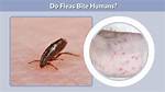 Why Do Fleas Bite Me?