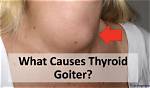 Why Do Goiter Grow?