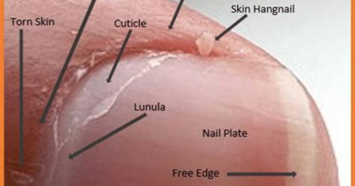 Why Do Hangnails Form?