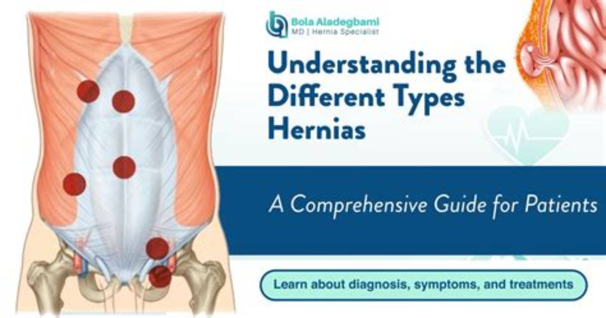 Why Do Hernias Occur?