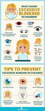 Why Do I Blink So Much? Excessive Blinking Causes & Treatments