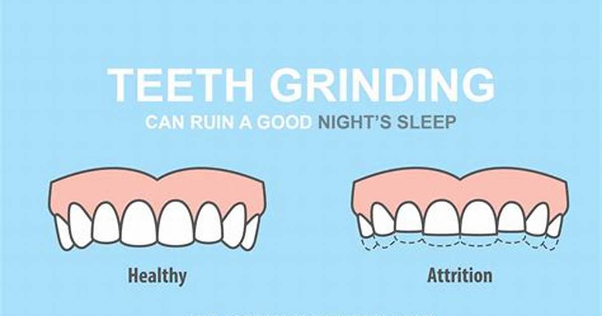 Why Do I Gnashed My Teeth While Sleeping?