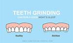 Why Do I Gnashed My Teeth While Sleeping?
