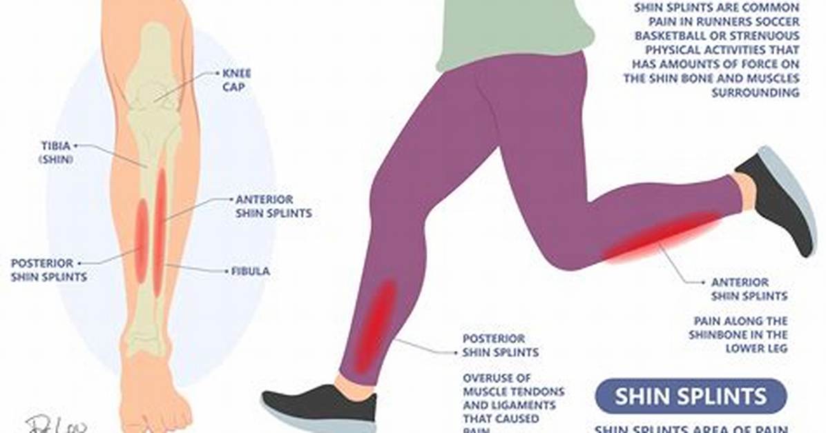 Why Do I Keep Getting Shin Splints When I Walk?