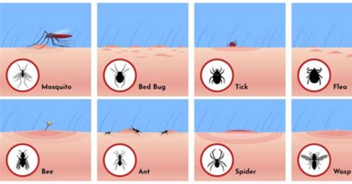 Why Do I Keep Getting Sting by Wasps?