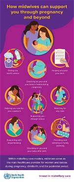 Why Do Midwives Do a Sweep?