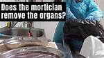 Why Do Morticians Remove Organs?