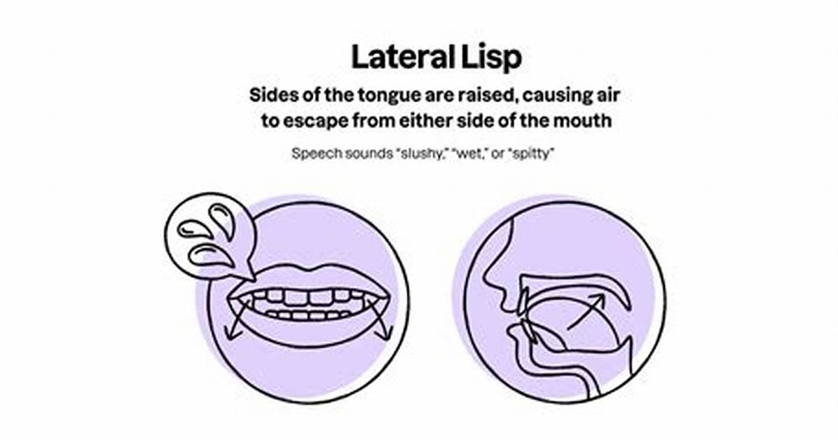 Why Do Nerds Have Lisps?