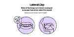 Why Do Nerds Have Lisps?