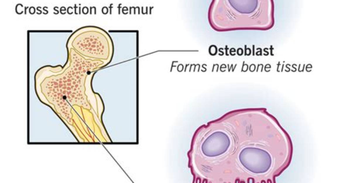 Why Do Osteoclasts Dissolve Bone?