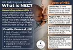 Why Do Preemies Get Nec?
