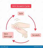 Why Do Scrapes Itch?