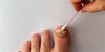 Why Do Toenails Randomly Fall off?