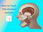 Why Do We Get Lockjaw?