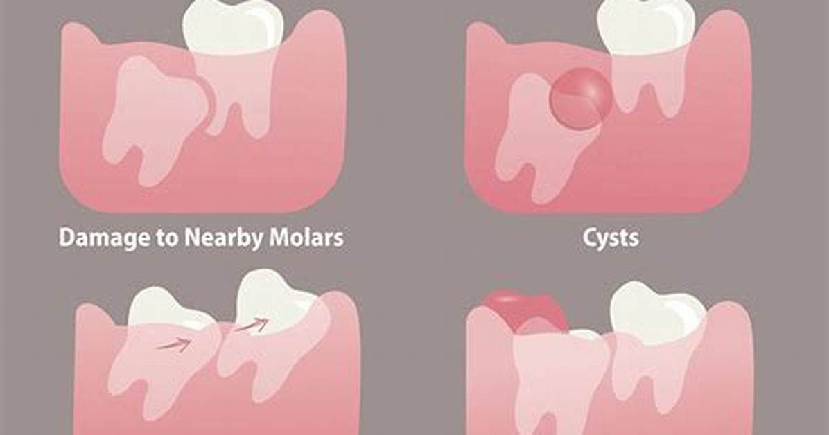 Why Do Wisdom Teeth Hurt?