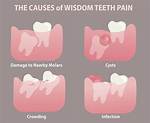 Why Do Wisdom Teeth Hurt?