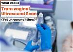 Why Do You Get a Sonogram?