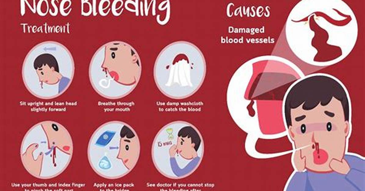 Why Do You Nosebleed?