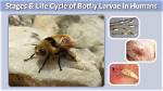 Why Does a Botfly Get Inside You?