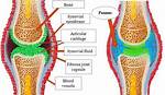 Why Does a Pannus Develop?