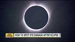 Why Does a Solar Eclipse Damage Your Eyes?