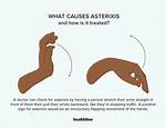 Why Does Asterixis Happen