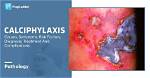 Why Does Calciphylaxis Occur?