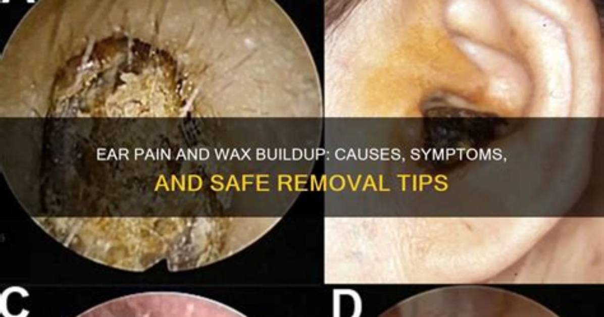 Why Does Cerumen Itch?