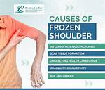 Why Does Cold Shoulder Mean?