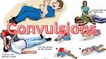 Why Does Convulsion Mean?