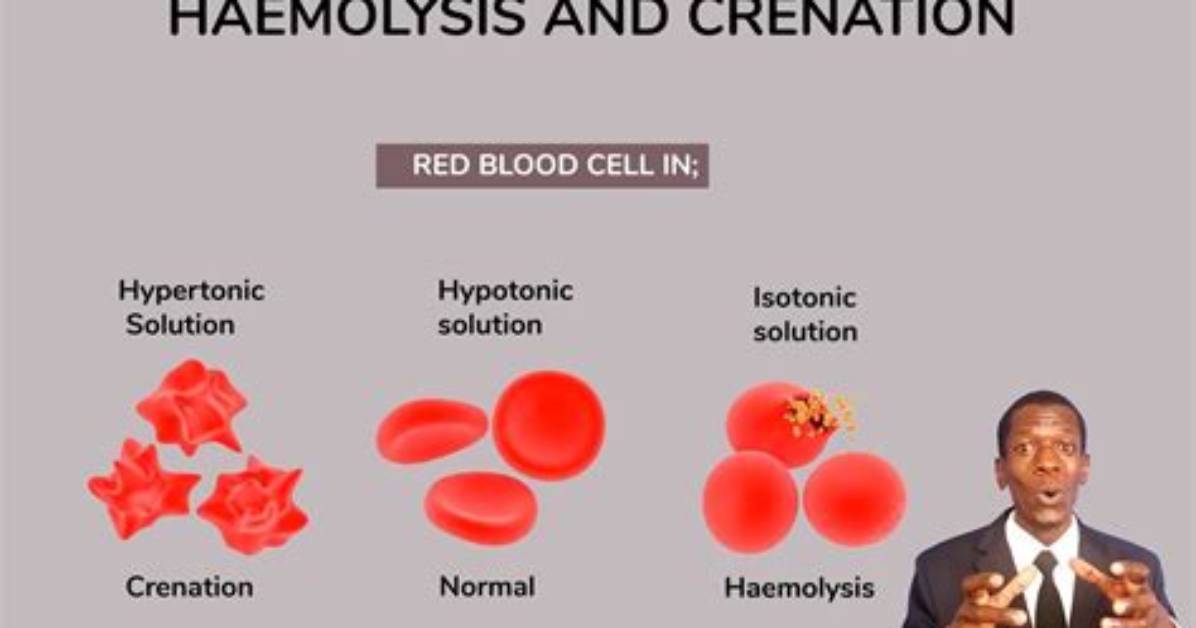 Why Does Crenation Occur?