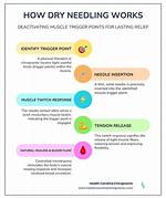 Why Does Dry Needling Hurt?